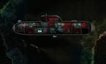 Barotrauma